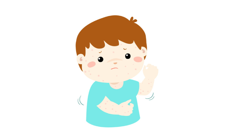 【子どもの腕にあせもが！どう対処すれば良い？】